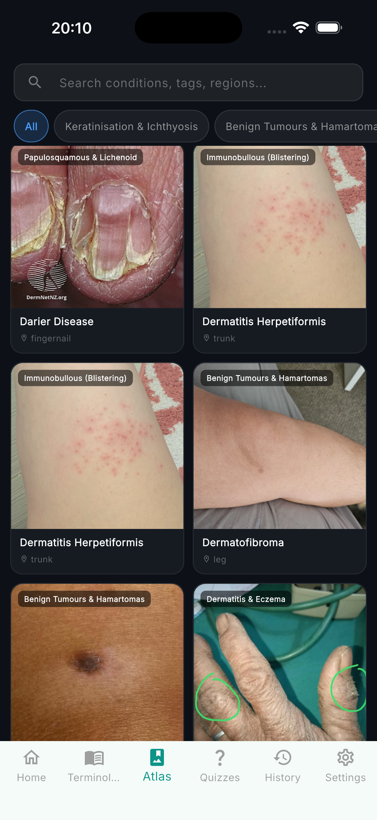 Dermatology Atlas