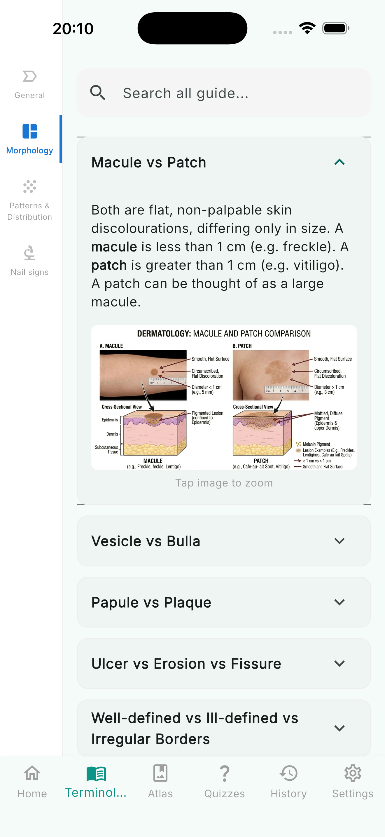 Term detail with image