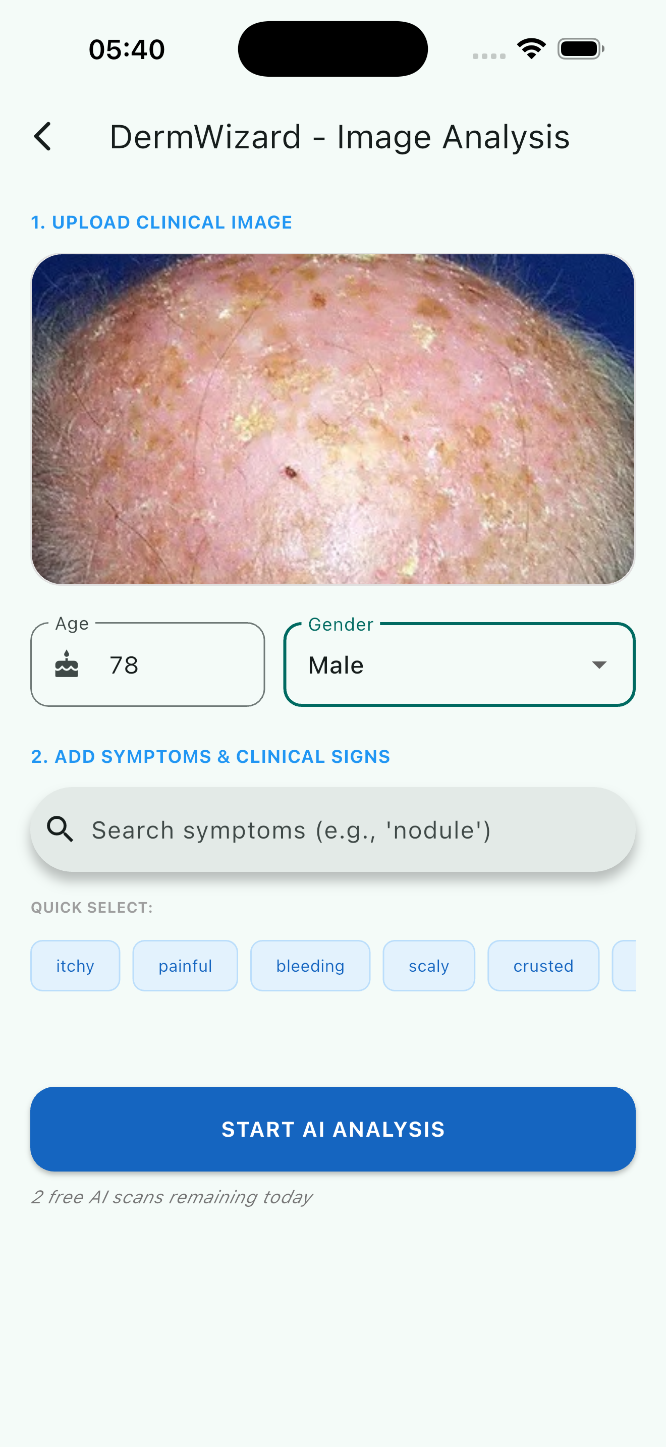 DermWizard AI Image Scanner Screen